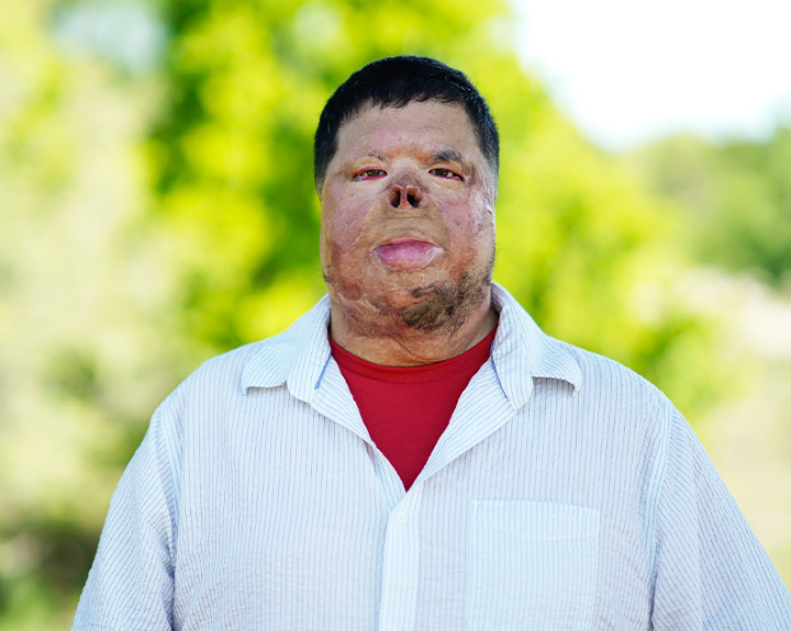 Wounded warrior Anthony Villareal stands against a blurred background of trees with a subtle smile.
